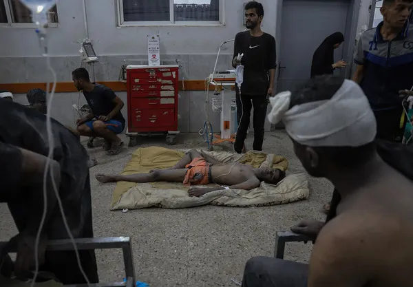شهادات مروعة لأطباء دوليين عملوا في غزة