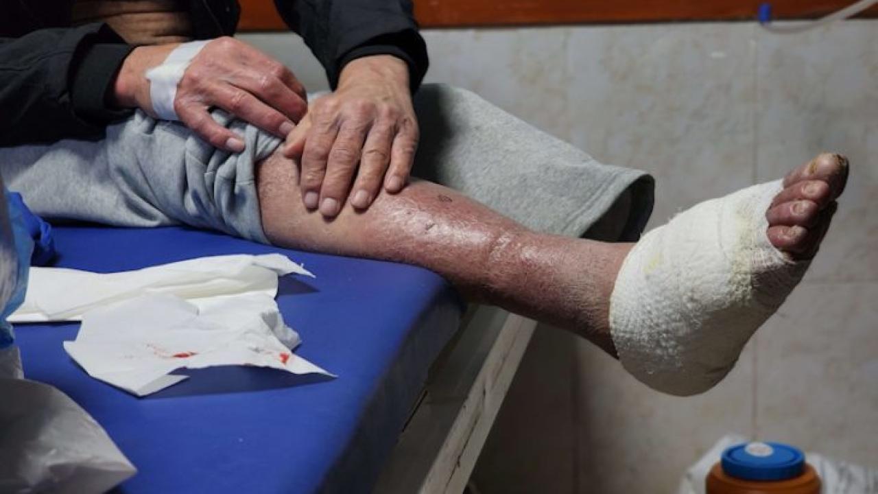 وسط إهمال طبي.. الجرب يتفشى بين أسرى فلسطينيين في سجن إسرائيلي