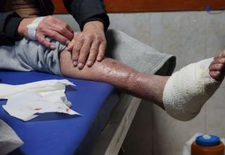 وسط إهمال طبي.. الجرب يتفشى بين أسرى فلسطينيين في سجن إسرائيلي