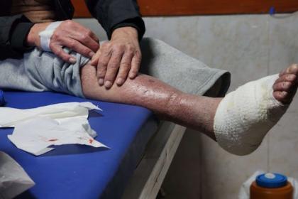 وسط إهمال طبي.. الجرب يتفشى بين أسرى فلسطينيين في سجن إسرائيلي